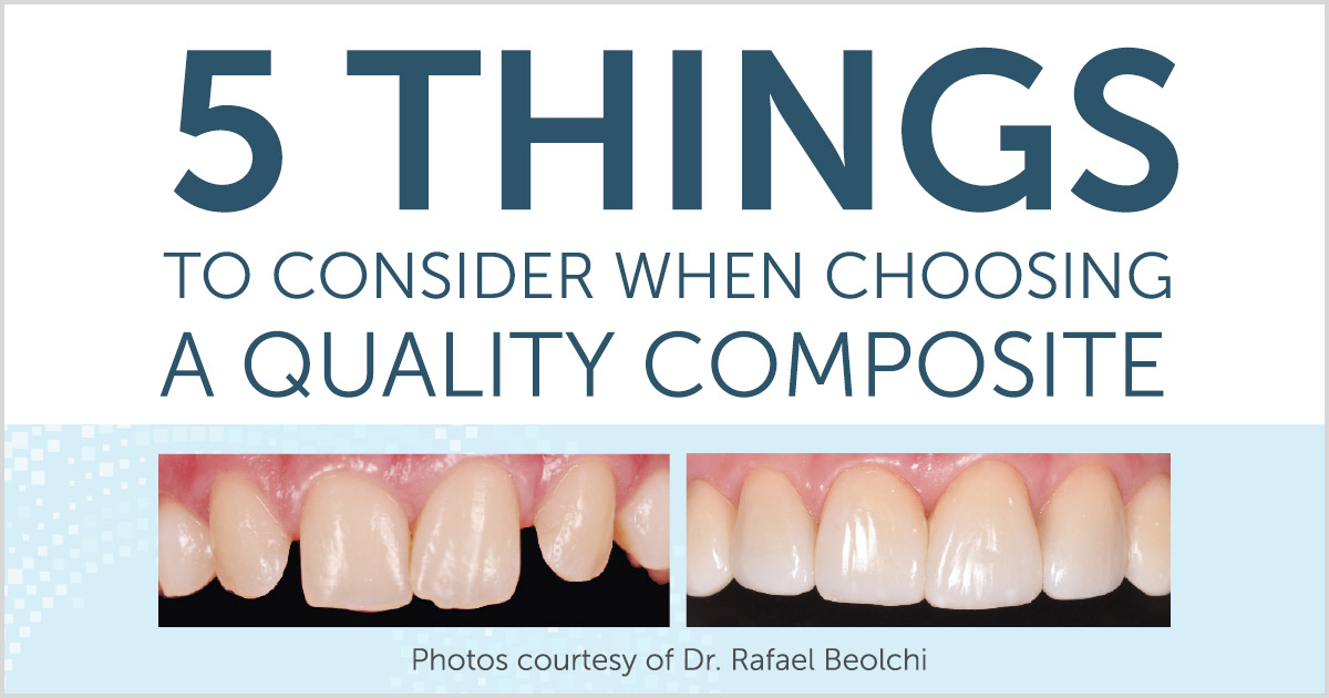 How To Choose A Quality Composite